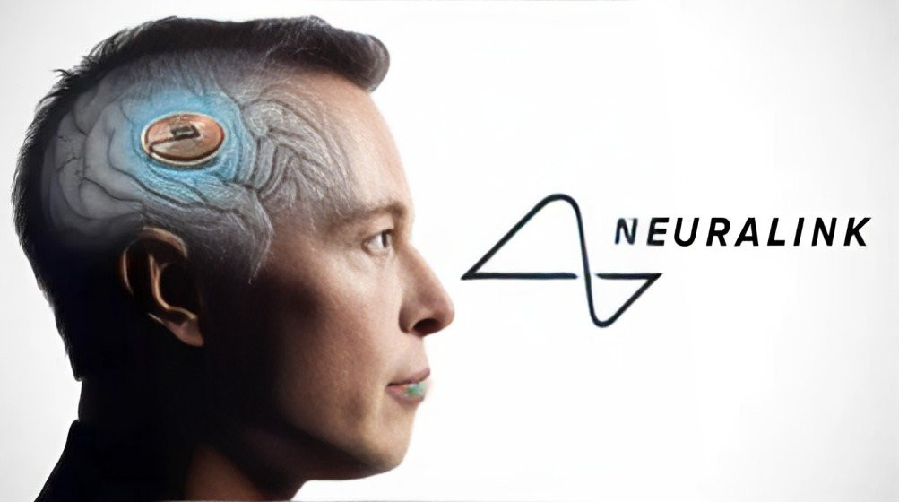 hito histórico de Neuralink, la empresa de Elon Musk, con el exitoso implante de chip cerebral inalámbrico en un ser humano.