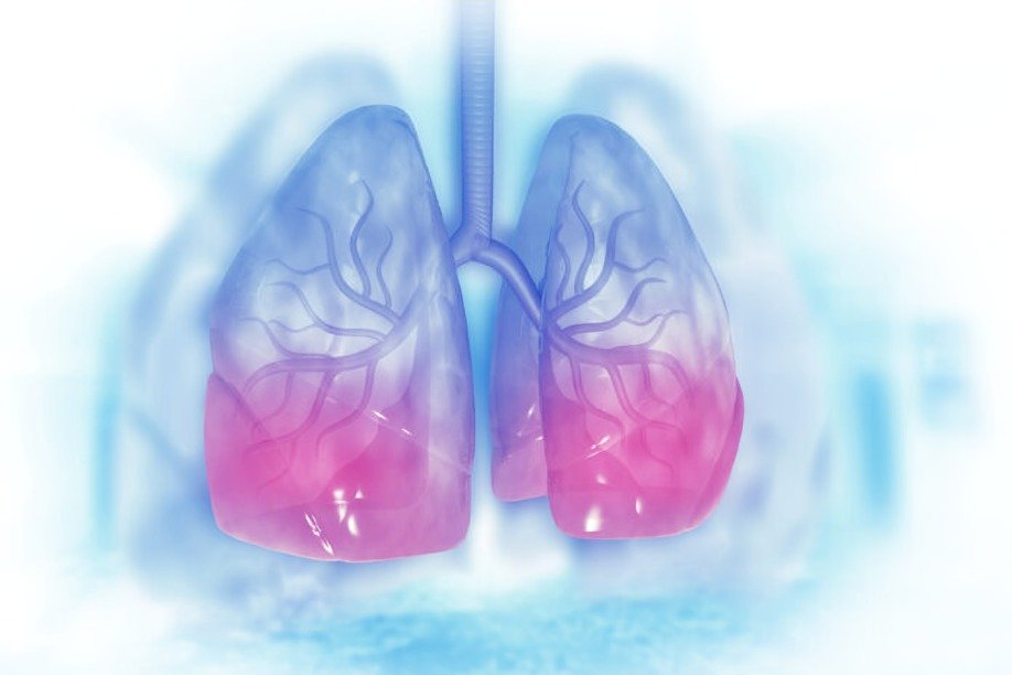 avances cáncer pulmón