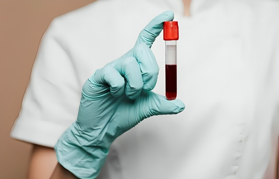 Factor VIII recombinante