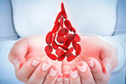 Factor VIII recombinante