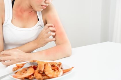 Mujer consultando con un nutricionista sobre alergia alimentaria o intolerancia