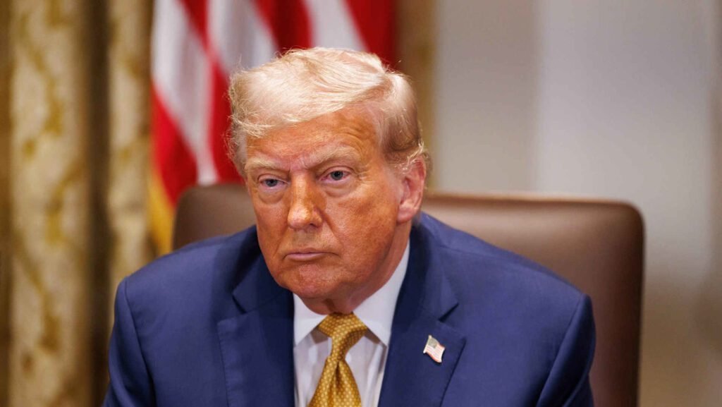 Donald Trump fue diagnosticado con insuficiencia venosa crónica en julio de 2025