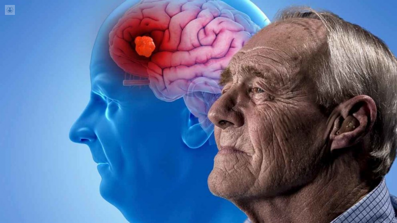 Litio y Alzheimer