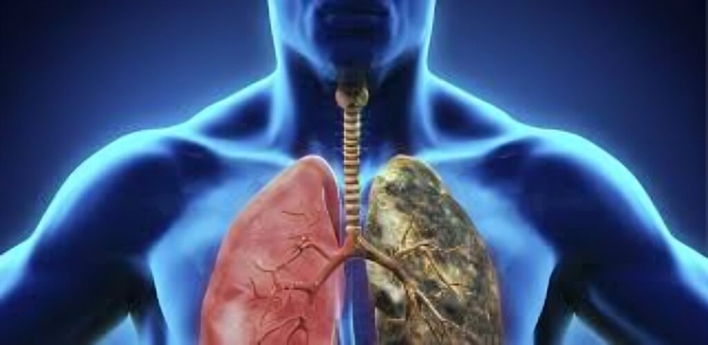 Nuevos tratamientos extienden la supervivencia en pacientes con cáncer de pulmón