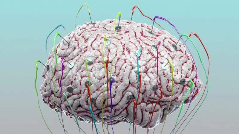 Diagrama de un dispositivo de estimulación cerebral profunda actuando sobre las neuronas para mejorar el funcionamiento del cerebro