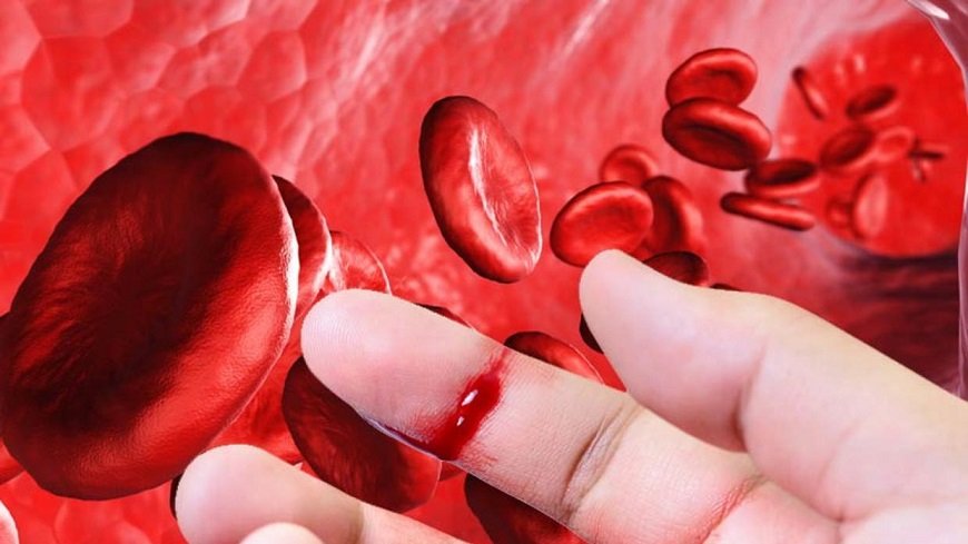 Paciente con hemofilia, muestra como sangra su dedo