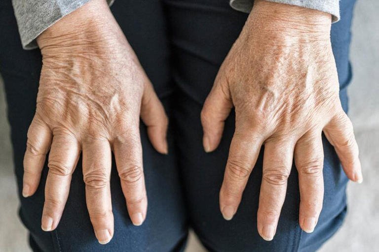 ujer mayor realizándose una densitometría ósea para diagnosticar osteoporosis.