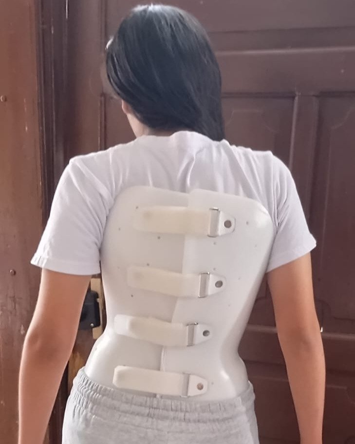 Daniela, beneficiaria de cirugías de alta complejidad en Ecuador, recibiendo apoyo de Fundación Metrofraternidad.