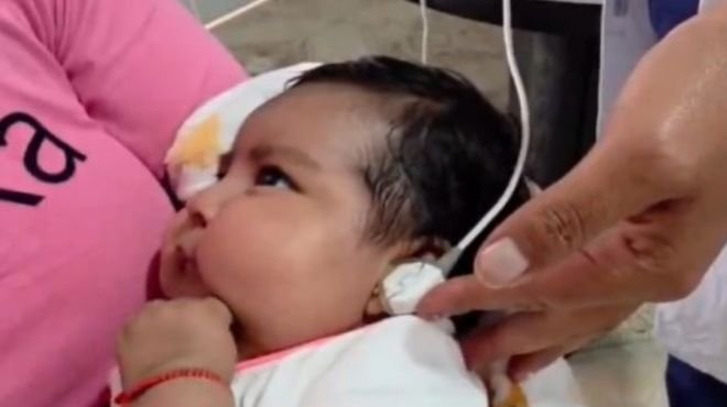 Profesional de salud coloca sonda auditiva a un bebé durante el tamizaje con otoemisiones acústicas para niños menores de un año en un centro de salud