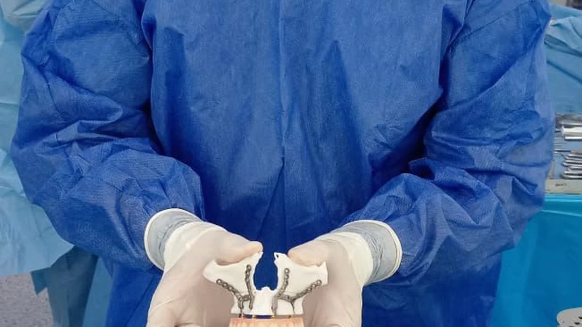Equipo técnico ecuatoriano trabajando en el diseño de un implante médico personalizado