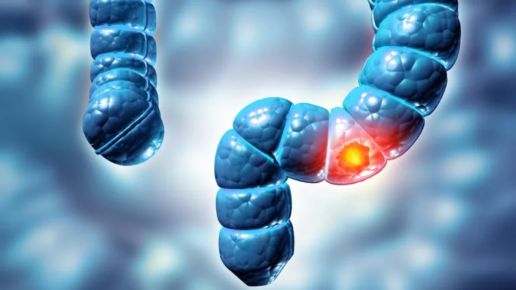Ilustración médica del colon y sistema digestivo para detección de cáncer