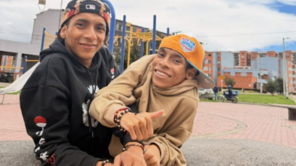 Fallecen en Colombia los siameses ecuatorianos tras 27 años unidos