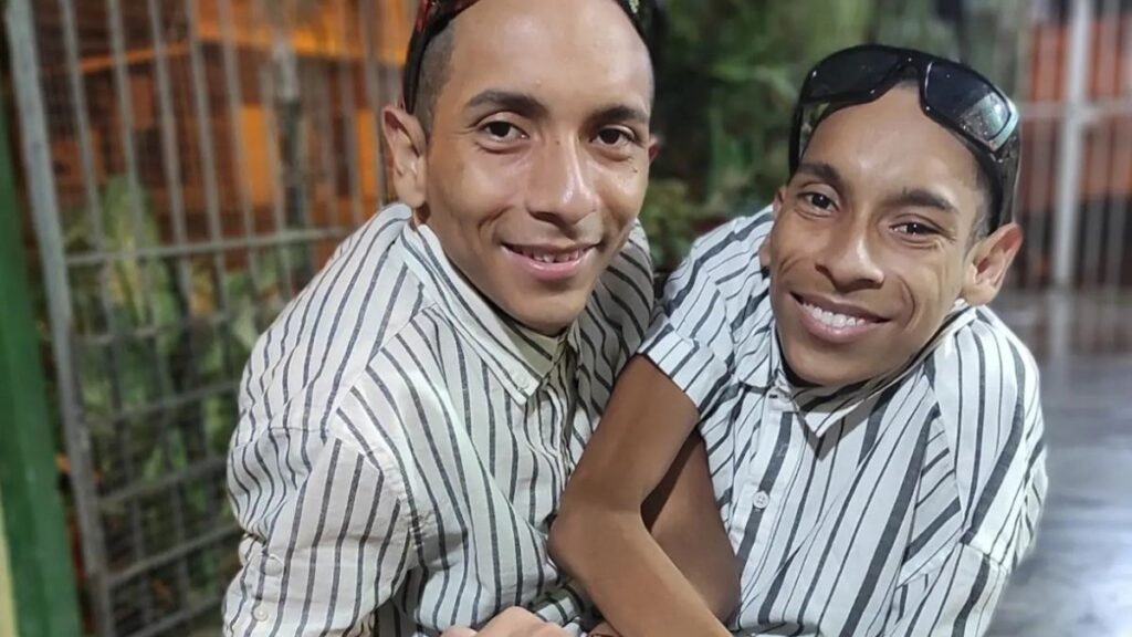 Familia de los siameses de Ecuador pide respeto y privacidad en su sepelio